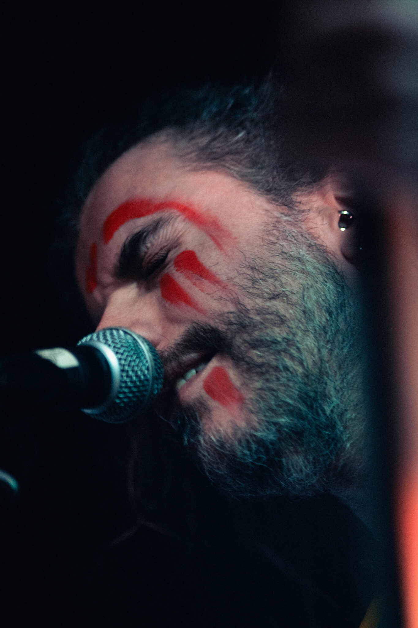 anomalfeito26_d3_usg-4
