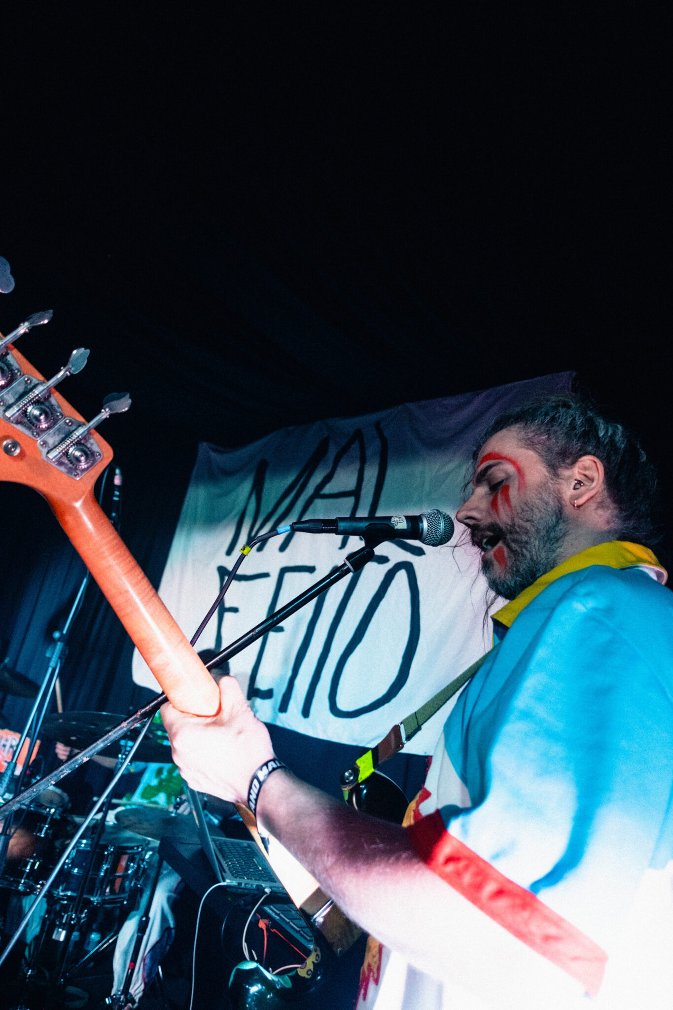 anomalfeito26_d3_usg-6